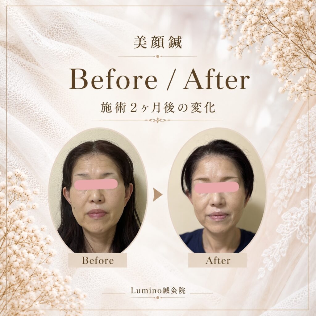 Lumino鍼灸院　